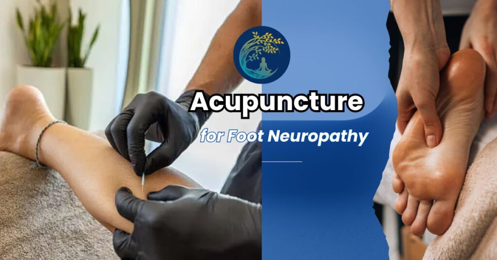 Is Acupuncture Good for Foot Neuropathy?