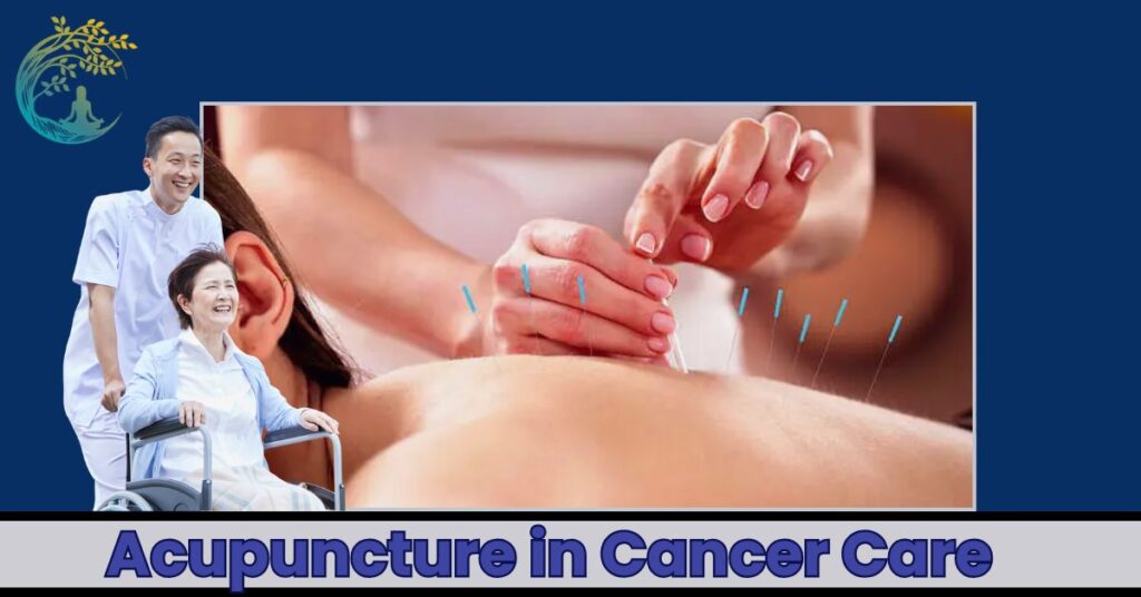 Acupuncture Do for Cancer Patients