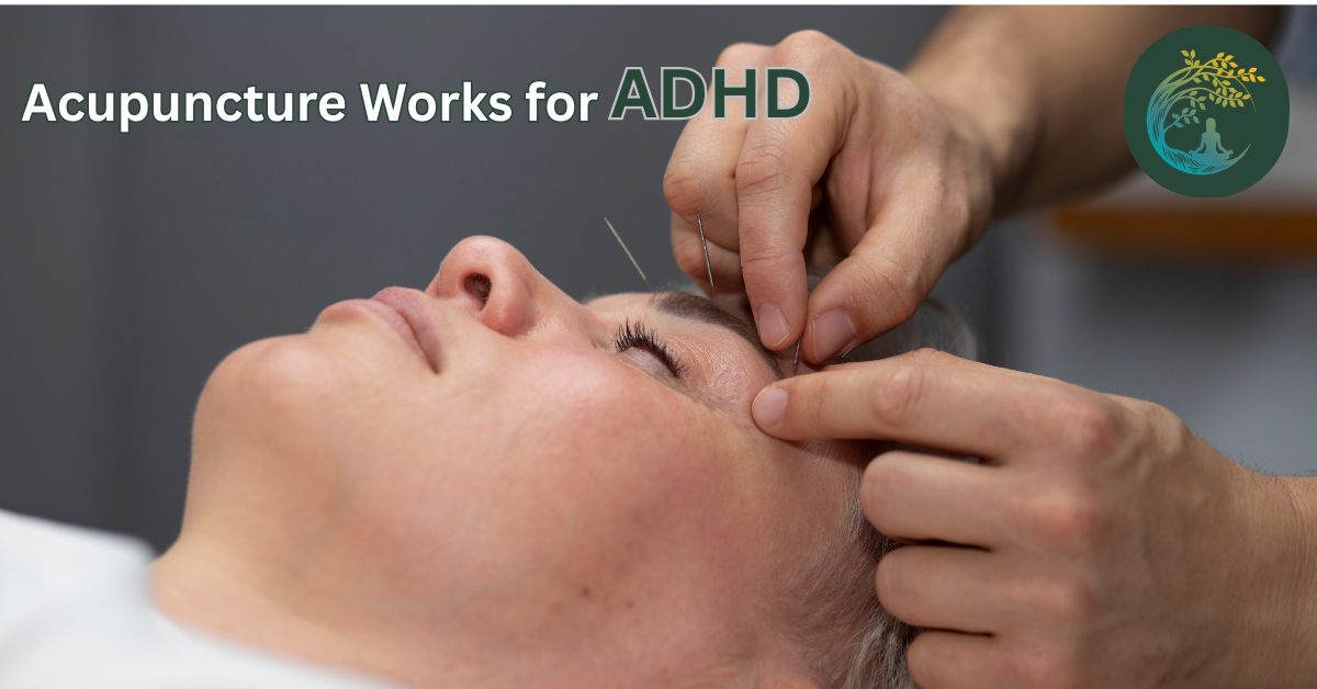 Does Acupuncture Work for ADHD?