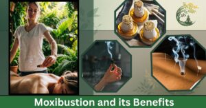 Moxibustion in Acupuncture