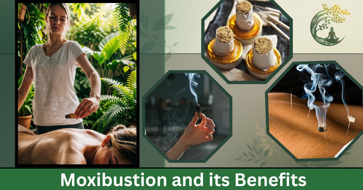 Moxibustion in Acupuncture